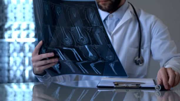 Kemik Kırığının Derecesine ve Hayat Fonksiyonlarına Etkisine Göre Kasten Yaralama Suçundan Verilecek Cezada Artırım Yapılması Gerekir - Kayseri Ceza Avukatı - Kayseri Ağır Ceza Avukatı - Av. Zülküf Arslan Hukuk Bürosu